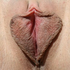 large labia 15