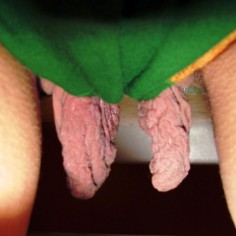 large labia 4