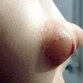Girls with puffy nipples  